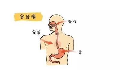 偶尔食道疼是怎么回事