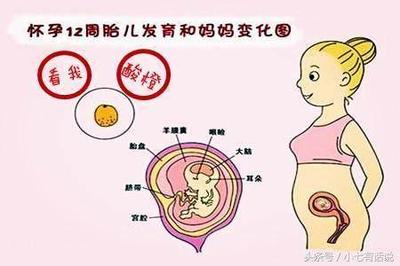 刚怀孕应注意哪些