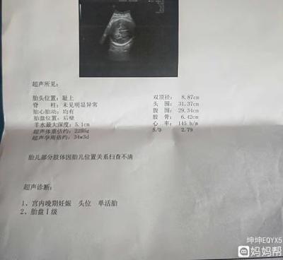 36周宝宝多少斤才正常