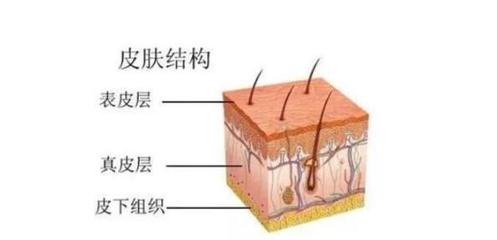 脚刺猴怎么治疗能根除