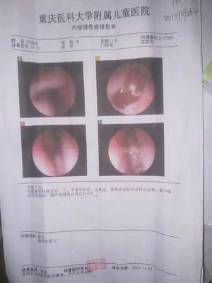 3岁宝宝一直眨眼睛怎么回事
