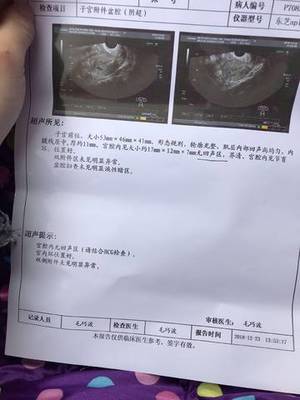 请问上环会怀孕吗