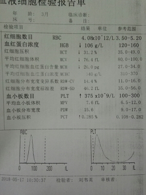 三个月宝宝贫血怎么办