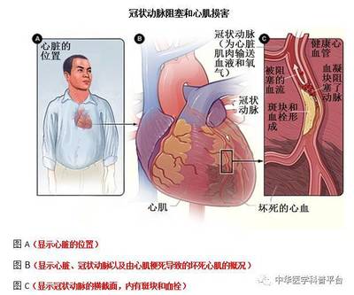 心脏衰弱怎么治疗