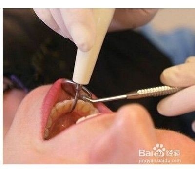 补牙什么科