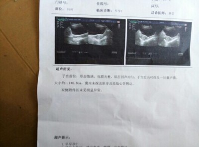 怎么才能确定是否怀孕