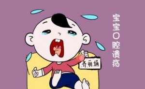 宝宝有口疮怎么办