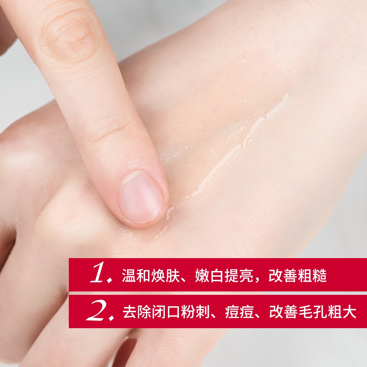 去痘痘 痘印