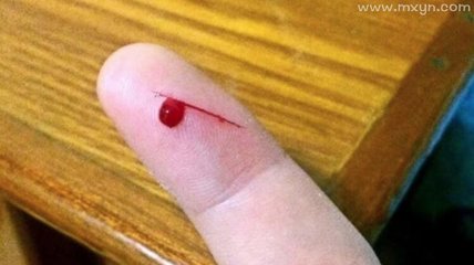 梦见自己手指流血