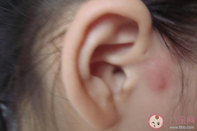 2岁宝宝耳朵瘘管手术多少钱