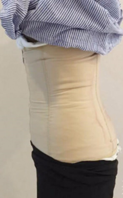 腰腹抽脂需要多少钱