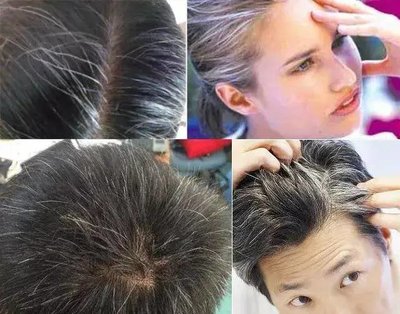 做梦头发断了