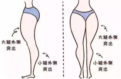 瘦腿哪里整容