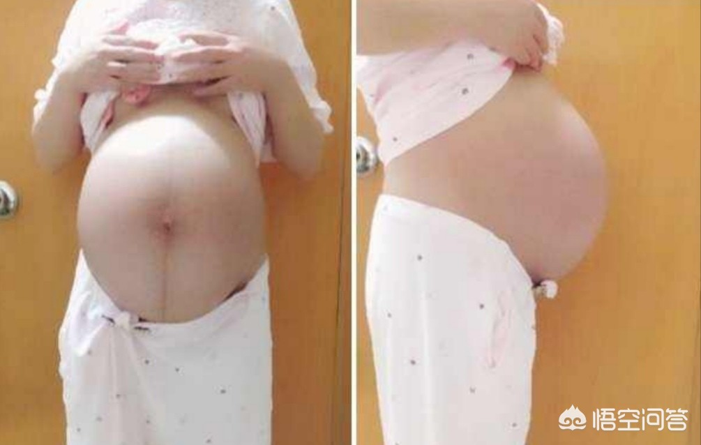 怀孕30几天有什么症状