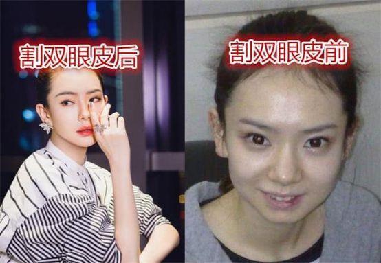 割双眼皮成功的明星