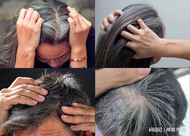 染发一定要漂白吗