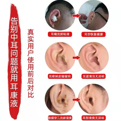 中耳炎怎么治疗除根