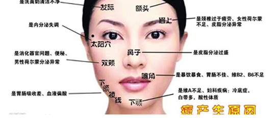 额头和脸上长痘痘怎么办