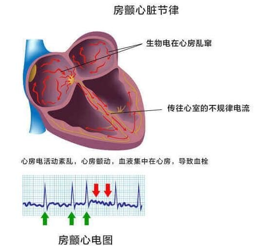 脉搏无力是怎么回事