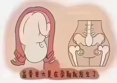 坐月子胯骨疼是怎么回事