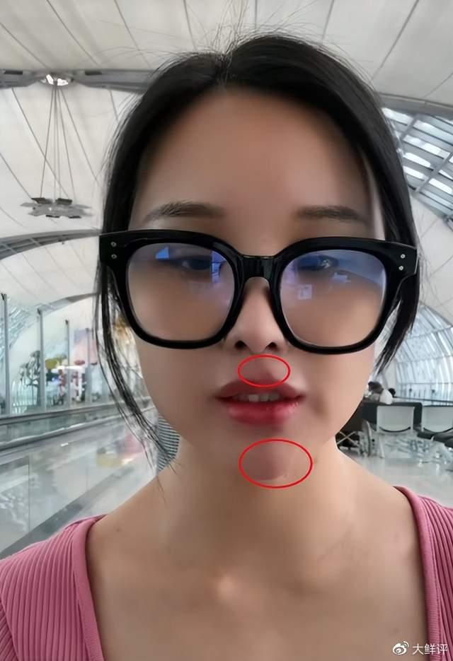 左边嘴巴长痘痘是什么原因