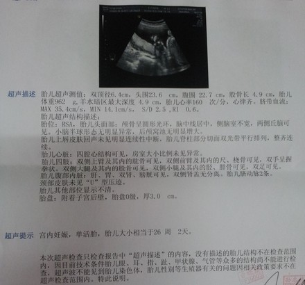 胎儿死亡赔偿标准
