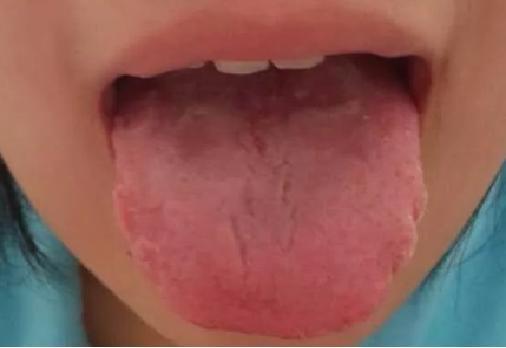 感觉胃热是怎么回事