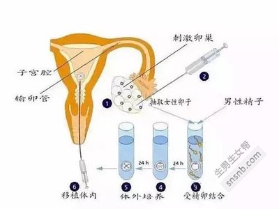 用别人的精子费用多少钱