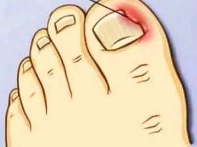 脚趾头疼痛是怎么回事
