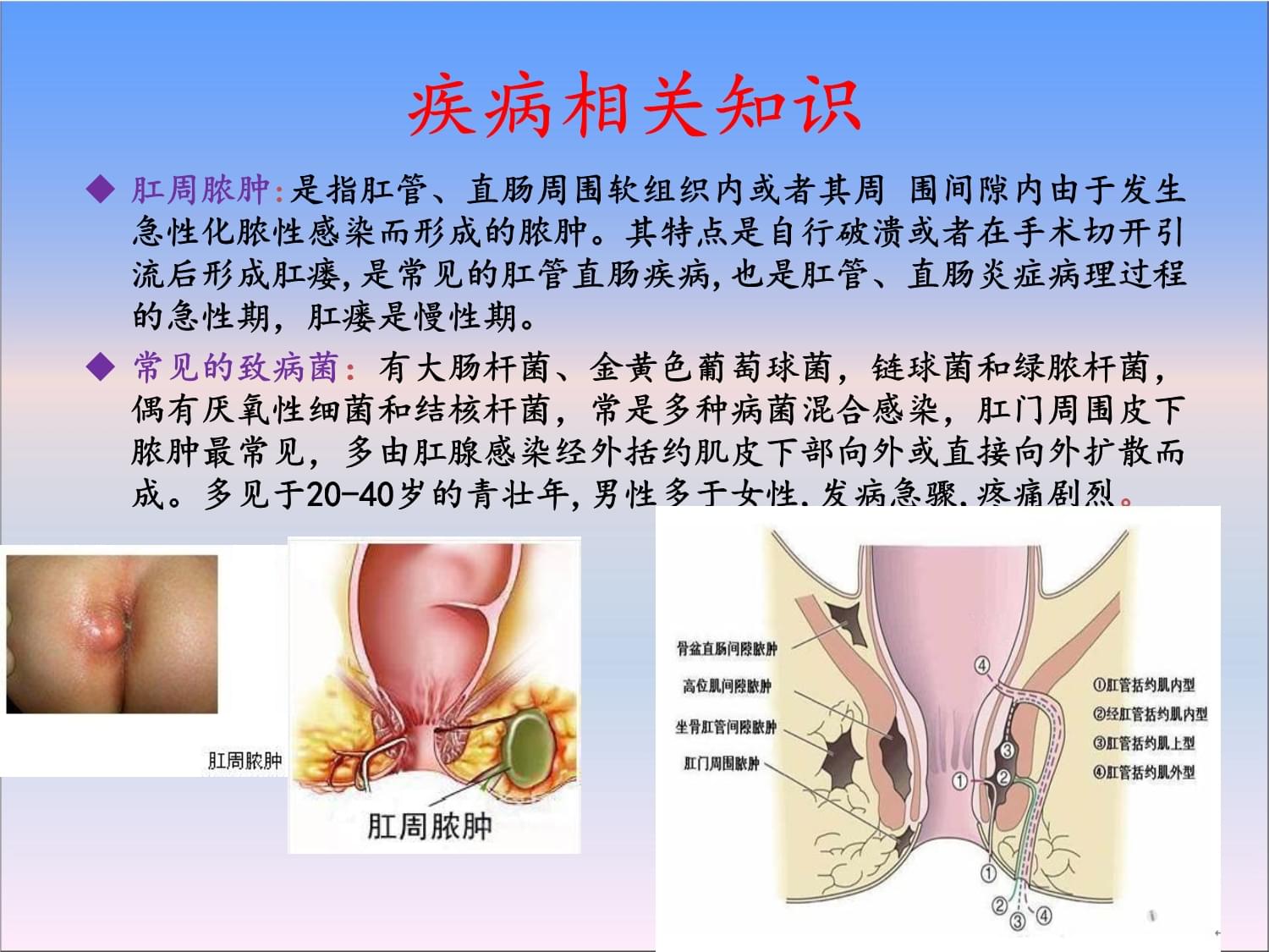 新生儿肛周脓肿图片