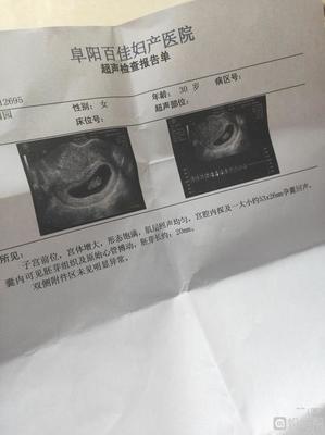 孕9周胎儿