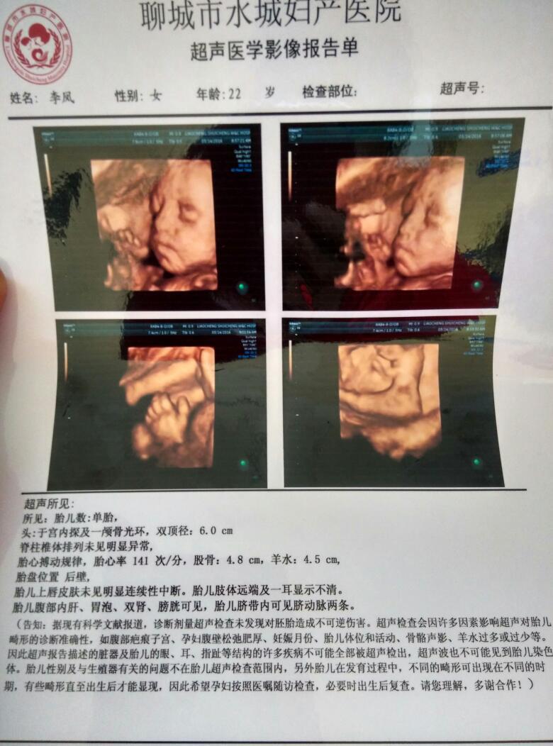 怀孕6个多月胎动少正常吗