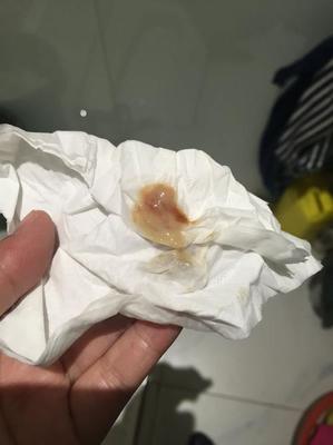 大便带脓是怎么回事