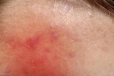 护发素的作用护发素的作用是什么?