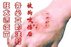 梦见别人给我打针出血
