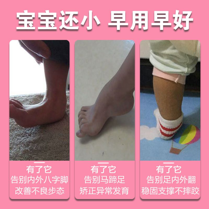新生儿左脚外翻怎么办