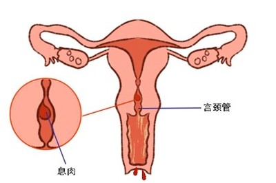 宫颈息肉手术后多少天能同床